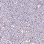 Immunohistochemical staining of human pancreas shows no cytoplasmic positivity in exocrine glandular cells as expected.