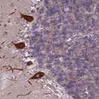 Anti-ZC3HAV1 Antibody