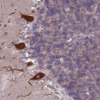 Immunohistochemical staining of human cerebellum shows strong cytoplasmic positivity in Purkinje cells.