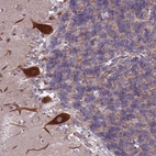 Immunohistochemical staining of human cerebellum shows strong cytoplasmic positivity in Purkinje cells.
