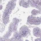 Immunohistochemical staining of human prostate shows no cytoplasmic positivity in glandular cells as expected.