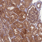 Immunohistochemical staining of human kidney shows strong cytoplasmic positivity in cells in tubules and moderate cytoplasmic positivity in cells in glomeruli.