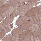 Immunohistochemical staining of human skeletal muscle shows moderate cytoplasmic positivity in myocytes.