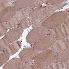 Immunohistochemical staining of human skeletal muscle shows moderate cytoplasmic positivity in myocytes.