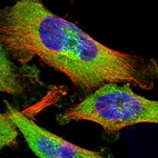 Immunofluorescent staining of human cell line U-251 MG shows localization to cytosol & the Golgi apparatus.