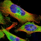 Immunofluorescent staining of human cell line U-251 MG shows localization to cytosol & the Golgi apparatus.