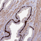 Immunohistochemical staining of human prostate shows strong membranous positivity in basal cells.