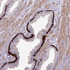 Immunohistochemical staining of human prostate shows strong membranous positivity in basal cells.