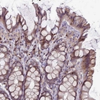 Immunohistochemical staining of human colon shows weak to moderate membranous/ cytoplasmic positivity in glandular cells.