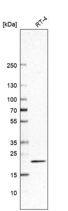 Western blot analysis in human cell line RT-4.