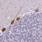 Immunohistochemical staining of human cerebellum shows strong positivity in Purkinje cells.