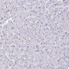 Anti-PPP1R17 Antibody