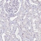 Immunohistochemical staining of human kidney shows no positivity in cells in tubules as expected.