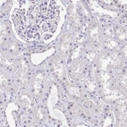 Immunohistochemical staining of human kidney shows no positivity in cells in tubules as expected.