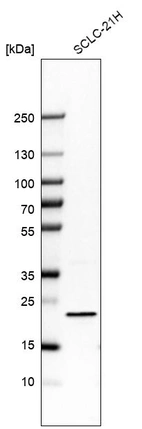 Western blot analysis in human cell line SCLC-21H.