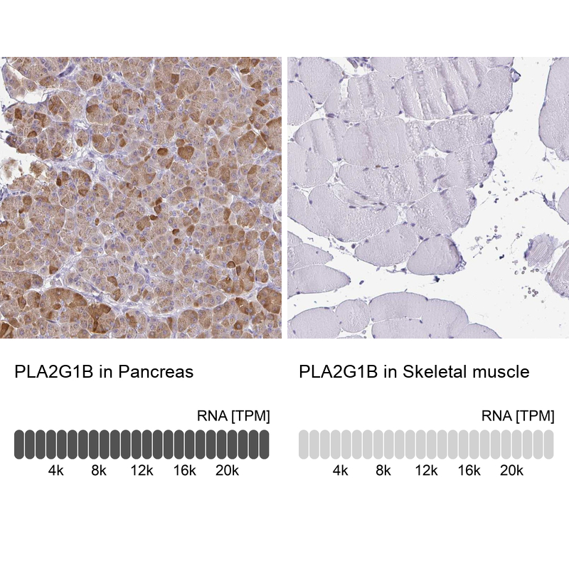 Anti-PLA2G1B Antibody