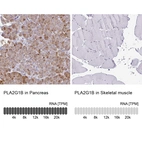 Anti-PLA2G1B Antibody