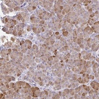 Anti-PLA2G1B Antibody
