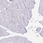 Immunohistochemical staining of human skeletal muscle shows low expression as expected.