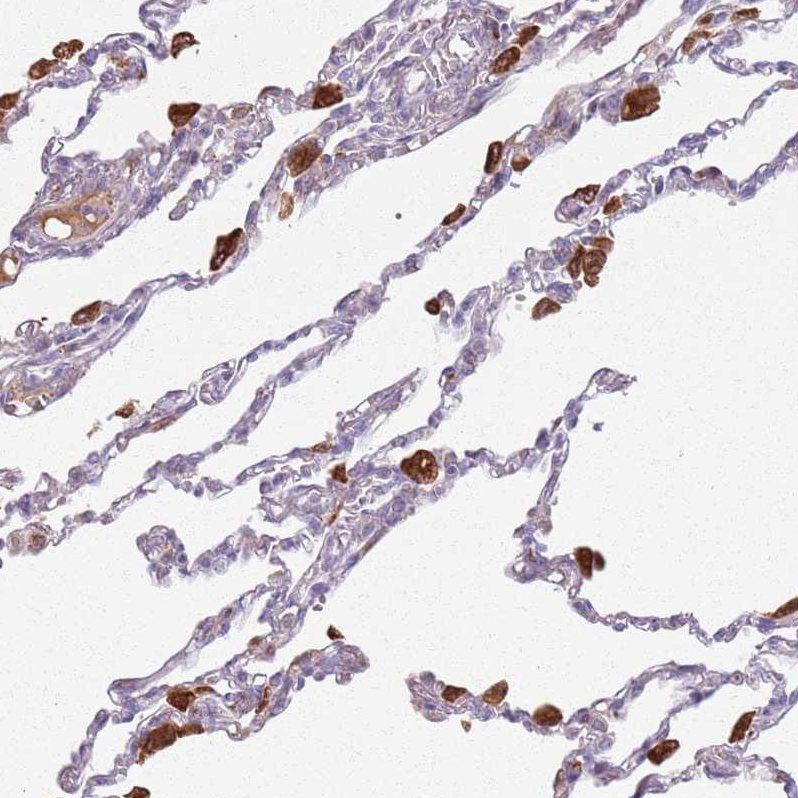Anti-COLGALT1 Antibody