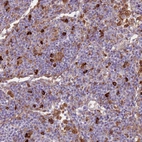 Immunohistochemical staining of human lymphoid node shows strong cytoplasmic positivity in non-germinal center cells.