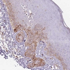 Immunohistochemical staining of human skin shows moderate cytoplasmic positivity in melanocytes.