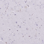 Immunohistochemical staining of human cerebral cortex shows no cytoplasmic positivity in neuronal cells as expected.