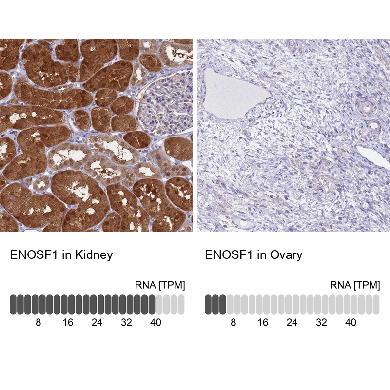 Anti-ENOSF1 Antibody