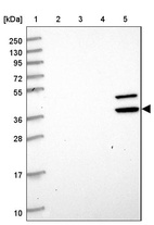 Lane 1: Marker [kDa] 250, 130, 95, 72, 55, 36, 28, 17, 10_br/_Lane 2: Human cell line RT-4_br/_Lane 3: Human cell line U-251MG sp_br/_Lane 4: Human plasma (IgG/HSA depleted)_br/_Lane 5: Human liver tissue