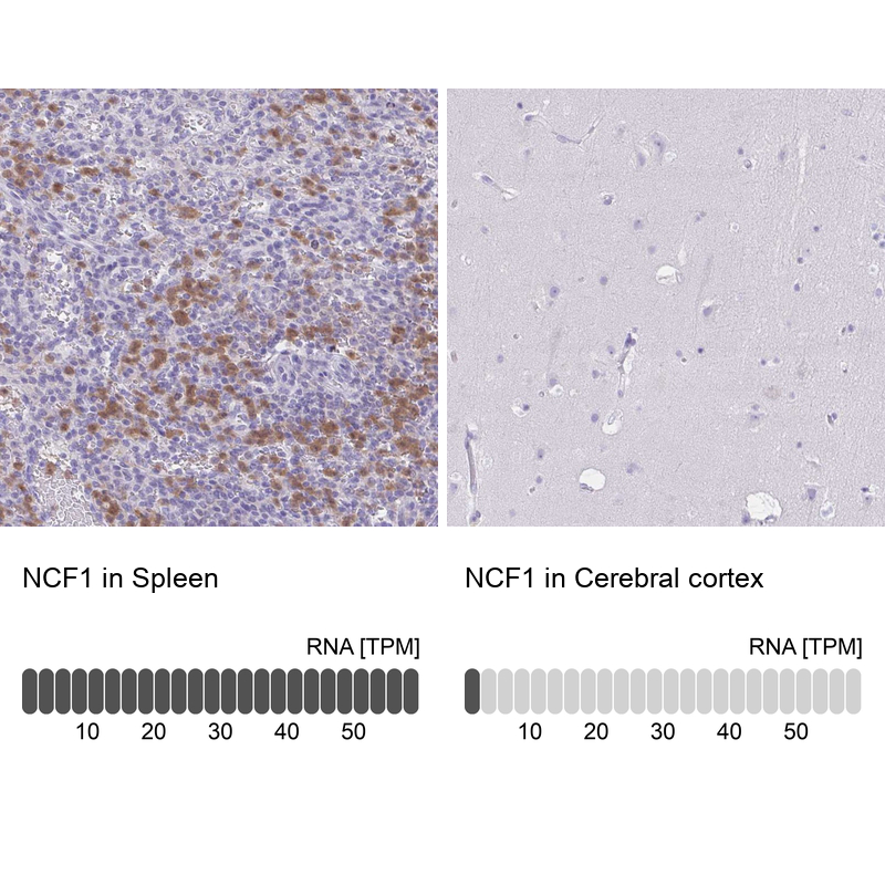 Anti-NCF1 Antibody