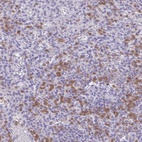 Anti-NCF1 Antibody