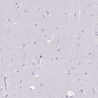Immunohistochemical staining of human cerebral cortex shows low expression as expected.
