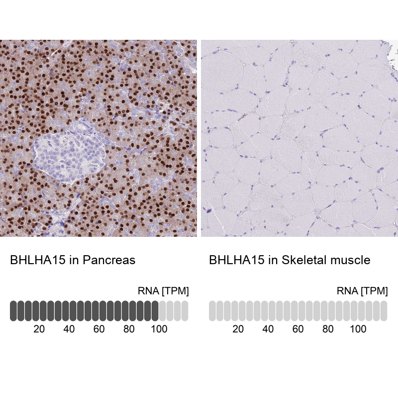Anti-BHLHA15 Antibody