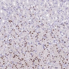 Immunohistochemical staining of human stomach shows moderate to strong nuclear positivity in a subset of glandular cells.