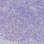 Immunohistochemical staining of human tonsil shows moderate to strong nuclear positivity in non-germinal center cells.