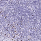 Immunohistochemical staining of human tonsil shows moderate to strong nuclear positivity in non-germinal center cells.