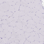 Immunohistochemical staining of human skeletal muscle shows no positivity in striated muscle fibers as expected.