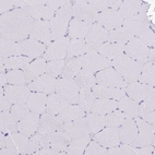 Immunohistochemical staining of human skeletal muscle shows no positivity in striated muscle fibers as expected.