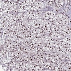 Anti-TOB1 Antibody