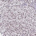 Anti-TOB1 Antibody