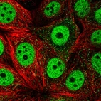 Immunofluorescent staining of human cell line MCF7 shows localization to nucleoplasm & vesicles.