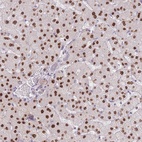 Anti-ZNF439 Antibody