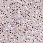 Anti-ZNF439 Antibody