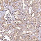 Immunohistochemical staining of human kidney shows moderate nuclear and cytoplasmic positivity in cells in tubules.