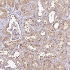 Immunohistochemical staining of human kidney shows moderate nuclear and cytoplasmic positivity in cells in tubules.