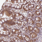 Immunohistochemical staining of human small intestine shows strong cytoplasmic positivity in glandular cells.