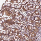 Immunohistochemical staining of human small intestine shows strong cytoplasmic positivity in glandular cells.