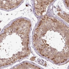 Immunohistochemical staining of human testis shows strong nuclear and cytoplasmic positivity in cells in seminiferous ducts.
