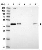 Lane 1: Marker [kDa] 250, 130, 95, 72, 55, 36, 28, 17, 10_br/_Lane 2: Human cell line RT-4_br/_Lane 3: Human cell line U-251MG sp_br/_Lane 4: Human plasma (IgG/HSA depleted)_br/_Lane 5: Human liver tissue_br/_Lane 6: Human tonsil tissue