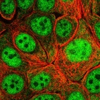 Immunofluorescent staining of human cell line MCF7 shows localization to nucleoplasm & cytosol.